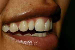 Images Tierrasanta Plaza Dental