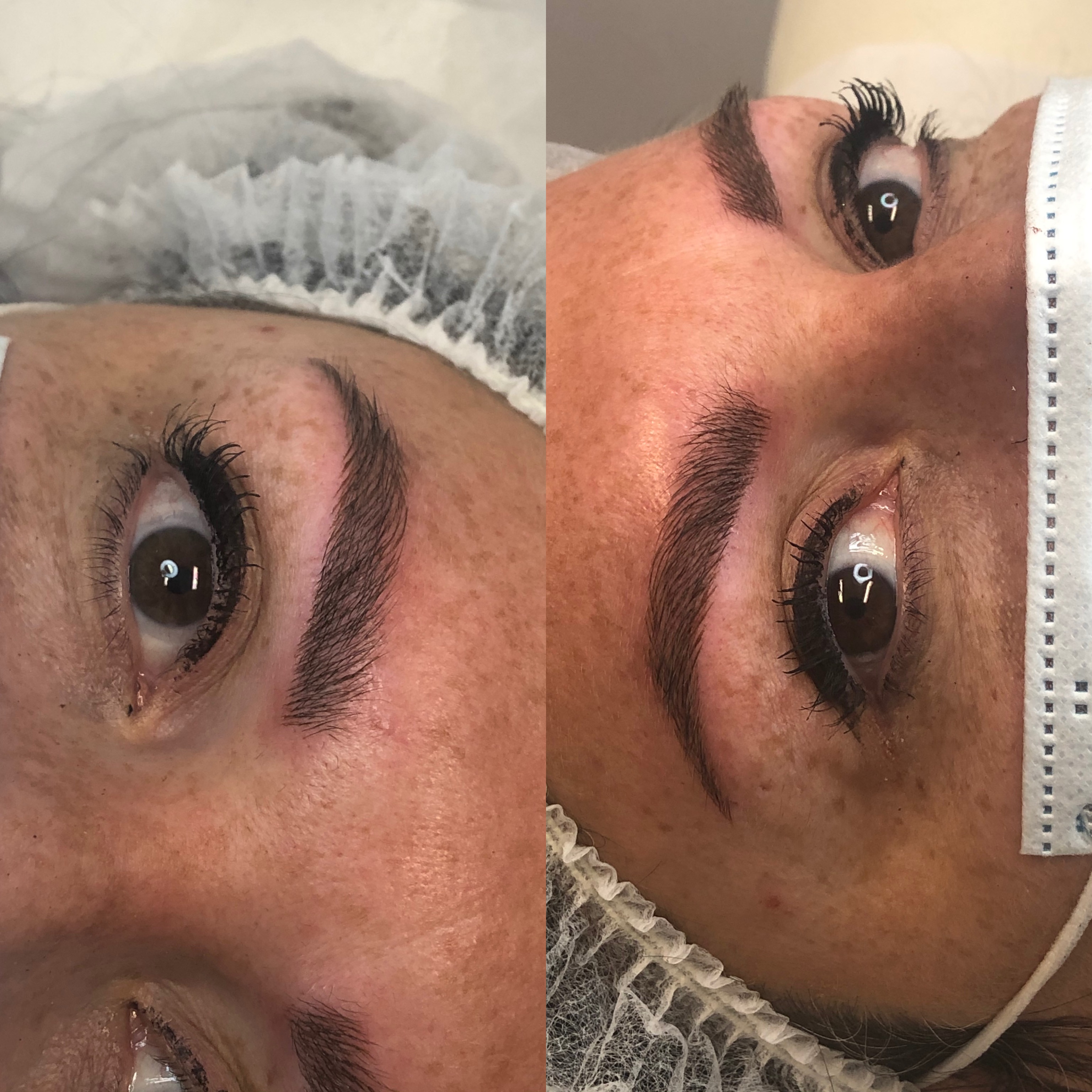 Images Clinique d'Esthétique Leila - Hydrafacial, Microblading, Épilation Laser Sainte-Foy