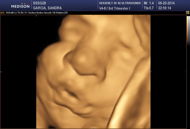 Images Heavenly 3D 4D Ultrasounds-Upland