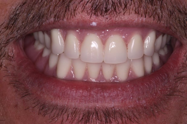 Images SmileCare Dental