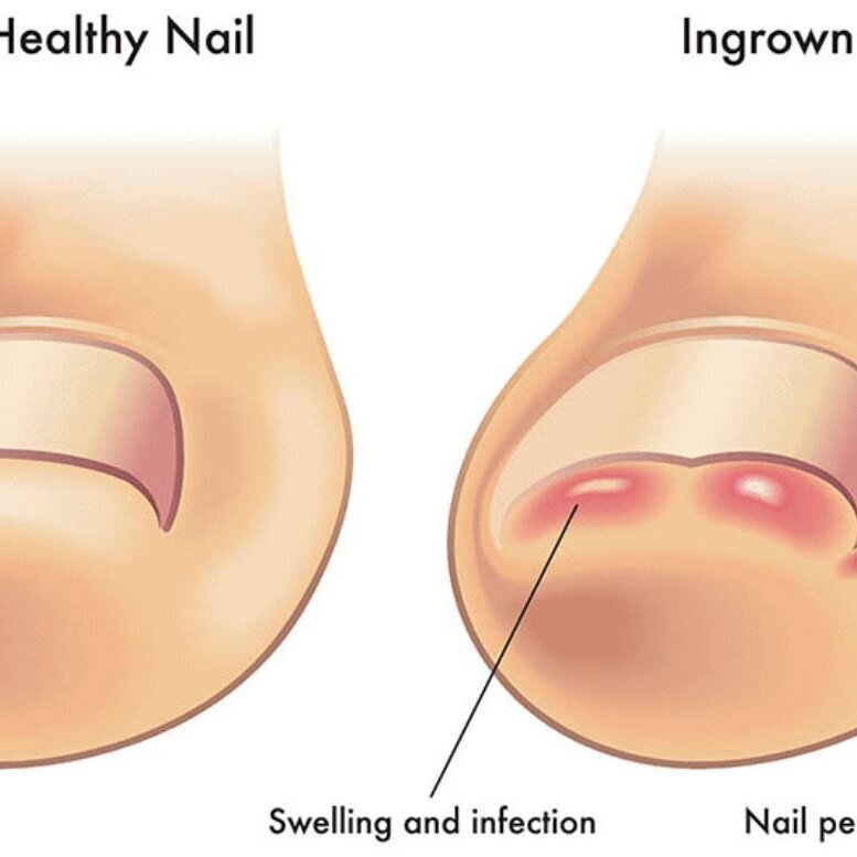 Images Frodsham Chiropody & Podiatry Clinic