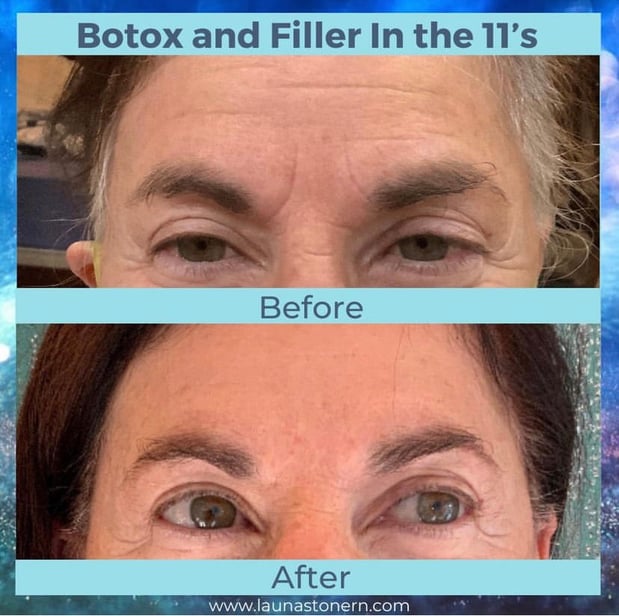 Images Launa Stone, R.N.