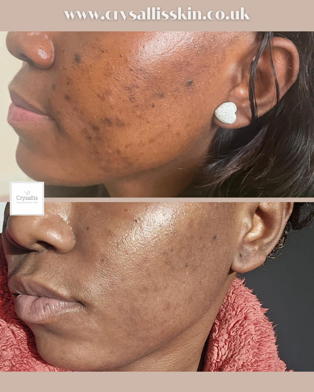Images Crysallis Skin Clinic