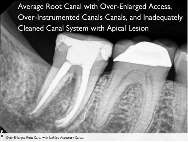 Images Tyler F Baker, DDS MS - Endodontic Specialists