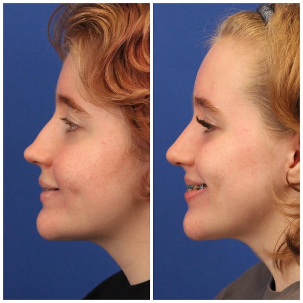 Images Dr. Sumit Bapna, MD