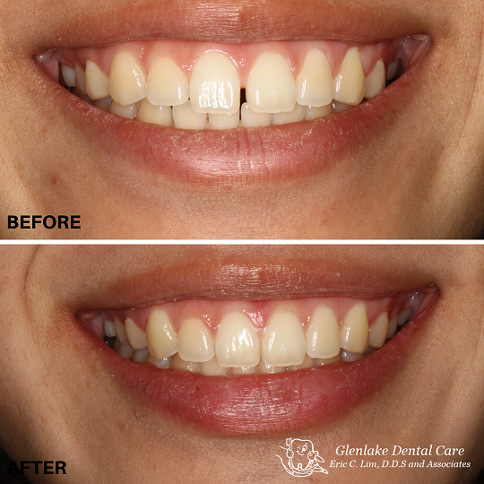 Images Glenlake Dental Care
