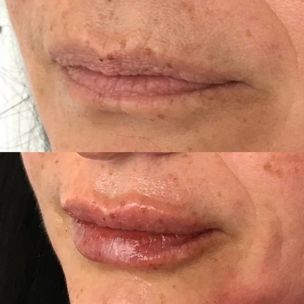 Images BCRN Aesthetics MedSpa