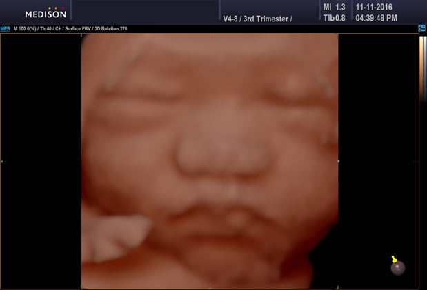 Images Heavenly 3D 4D Ultrasounds
