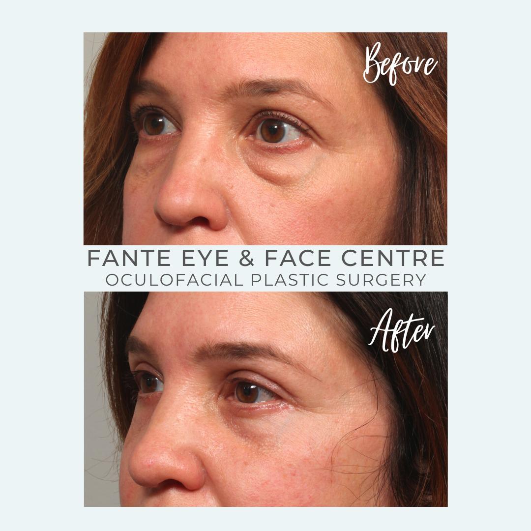 Image 7 | Fante Eye & Face Centre