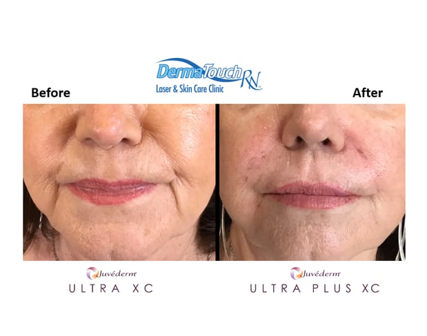 Images DermaTouch RN