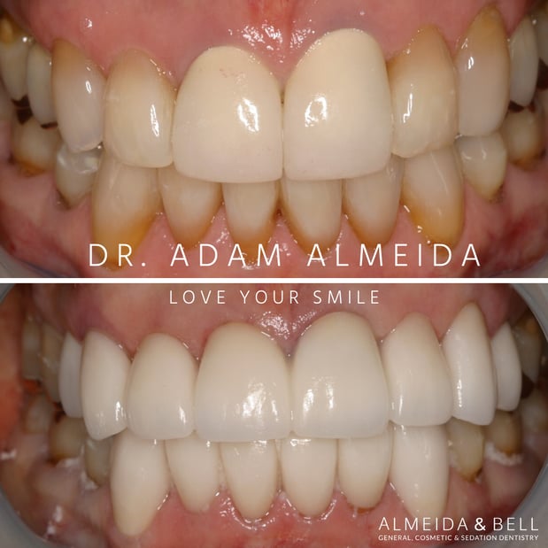 Images Almeida & Bell Dental Lone Tree - General, Cosmetic, and Implant Dentistry