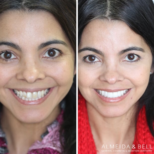 Images Almeida & Bell Dental Lone Tree - General, Cosmetic, and Implant Dentistry