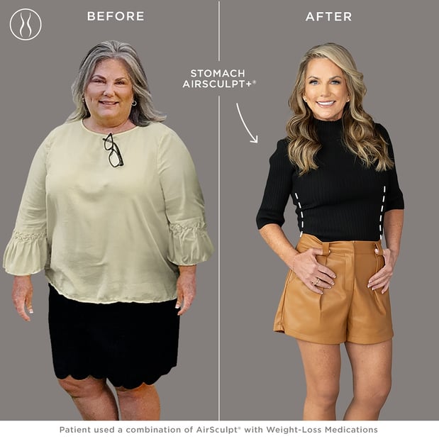 Images AirSculpt - Boston