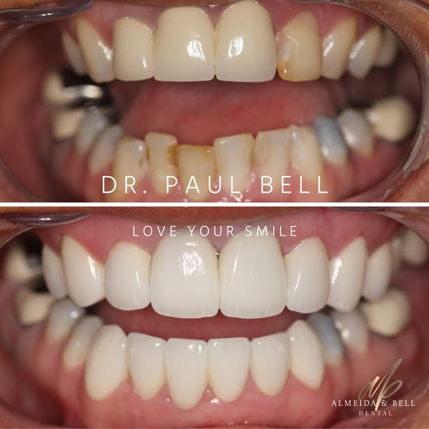 Images Almeida & Bell Dental Lone Tree - General, Cosmetic, and Implant Dentistry