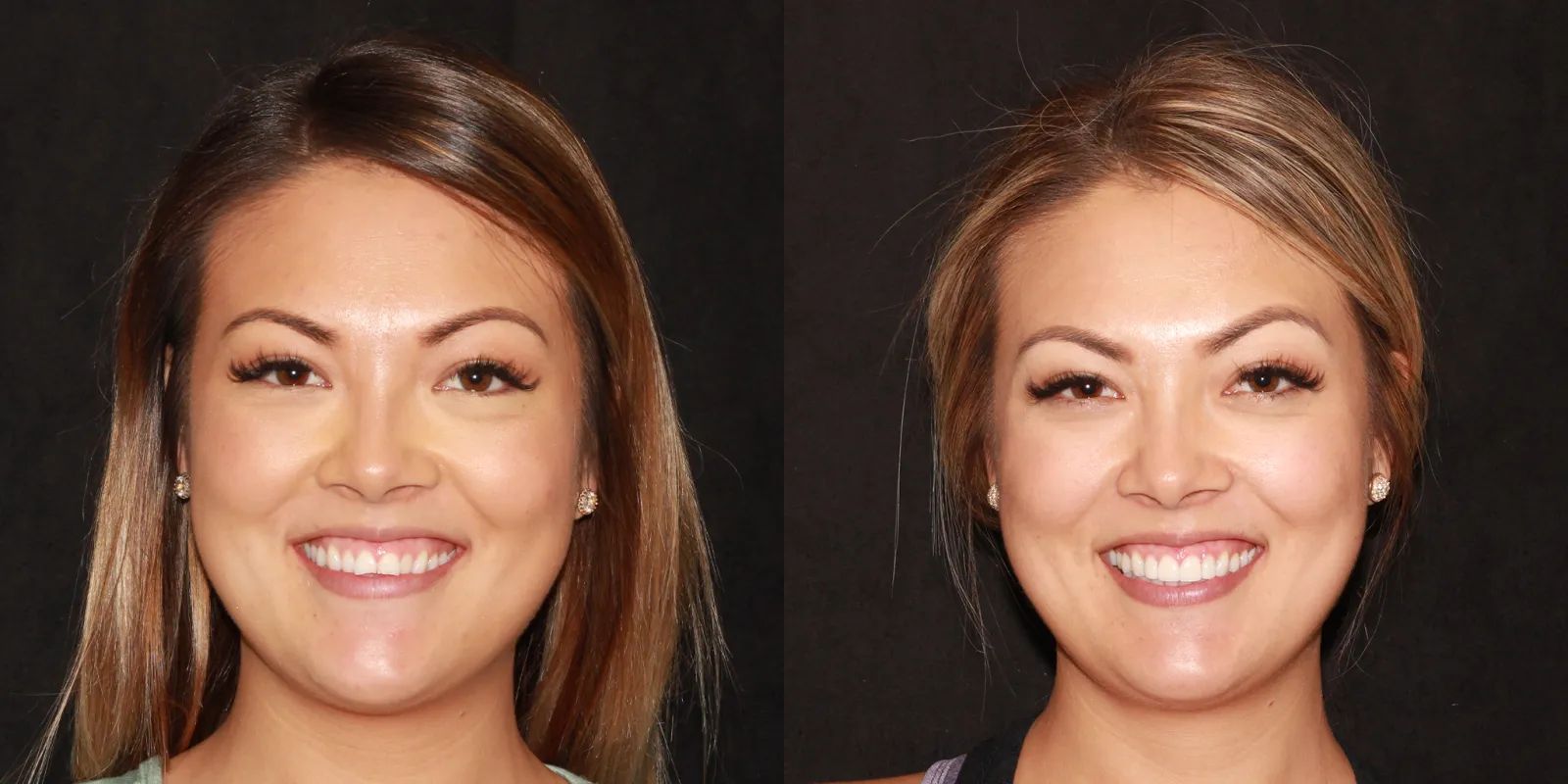 Intermountain Smiles Image