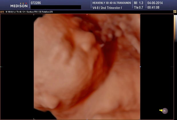 Images Heavenly 3D 4D Ultrasounds-Upland