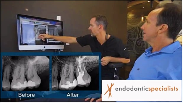 Images Tyler F Baker, DDS MS - Endodontic Specialists