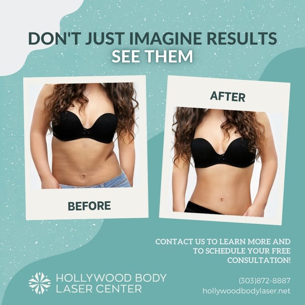 Images Hollywood Body & Face Denver/Metro