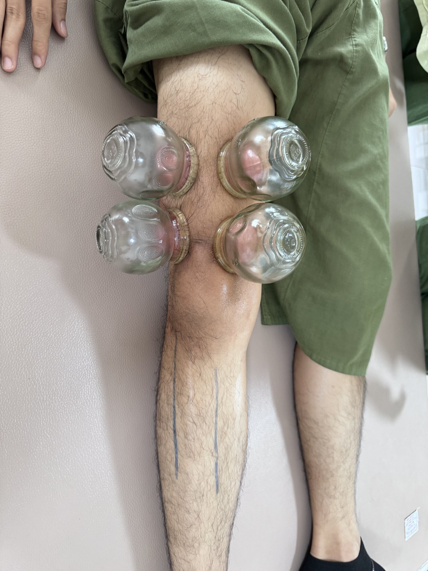 Bilder ThaiVital Thaimassage in Basel, Inhaberin: Natcha Samphan