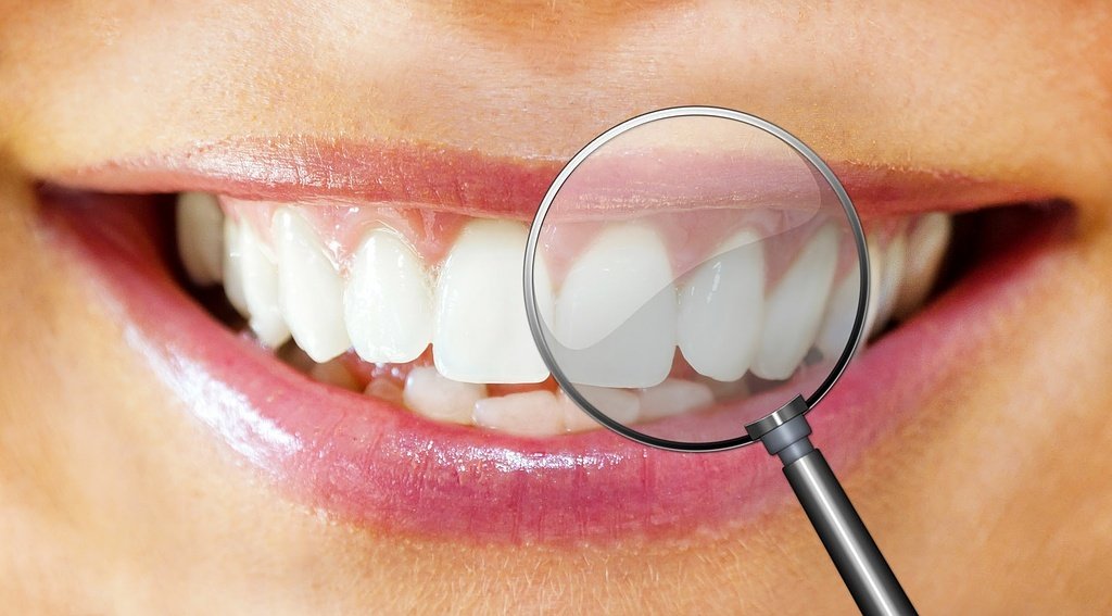 Bilder Zahnprothetik Vasi-Dental