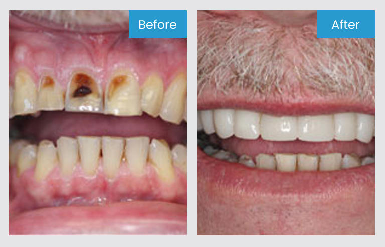 Images Katy Dentist | Smile Avenue Family Dentistry
