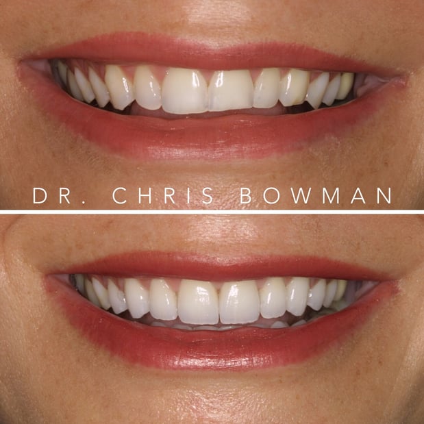 Images Advanced Dentistry of Charlotte
