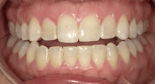 Images Dunwoody Dental