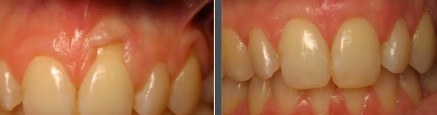 Images Embarcadero Dentistry