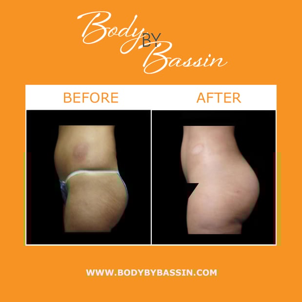 Images Body By Bassin Melbourne
