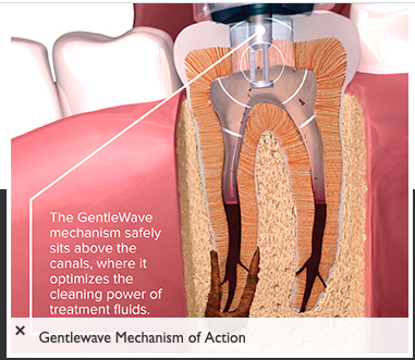 Images Tyler F Baker, DDS MS - Endodontic Specialists