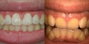 Images Haws Family Dentistry