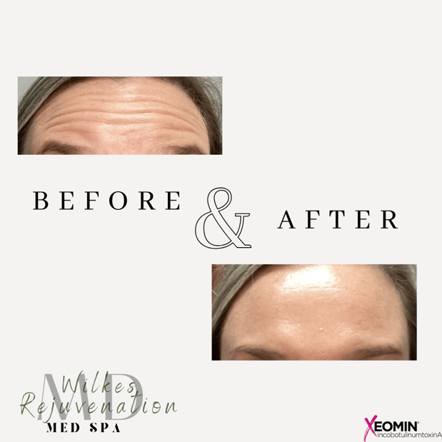 Images Wilkes Rejuvenation MD