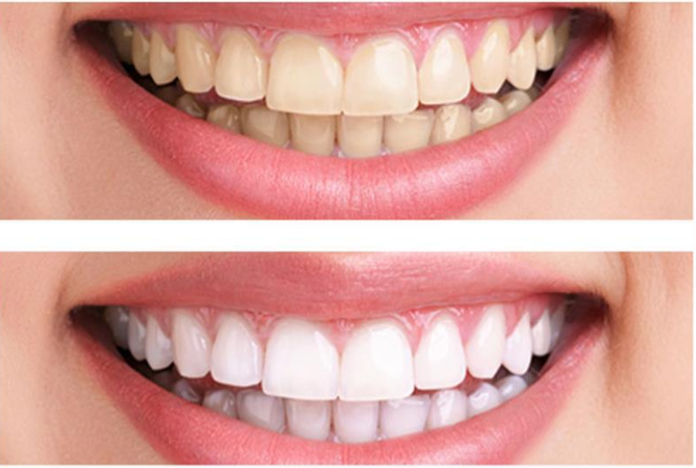 Images Natural Smiles Dentistry