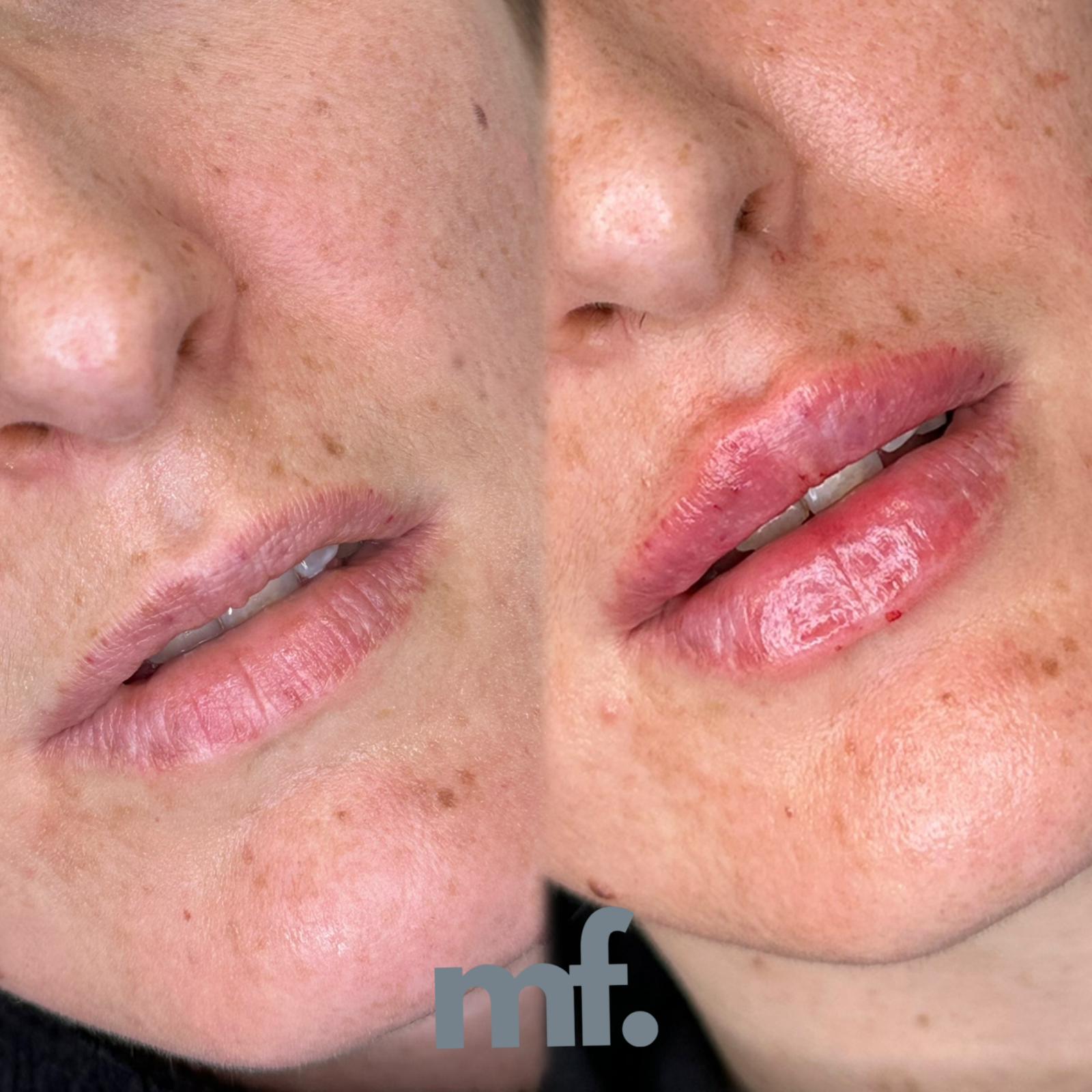 Images Monfer Dermoestetica