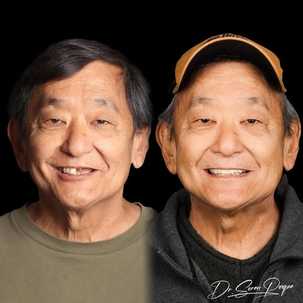 Images Smile Now Denver Dentures and Implants