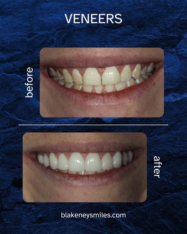 Images Advanced Dentistry of Blakeney