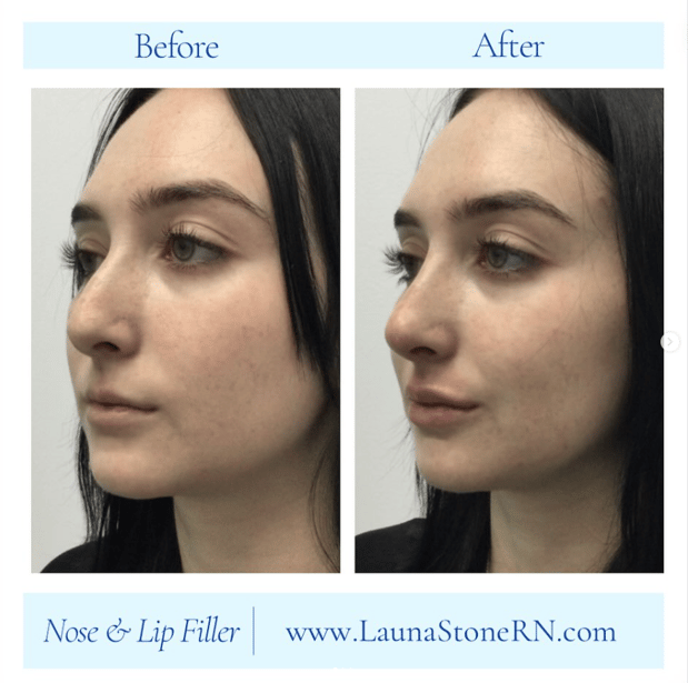 Images Launa Stone, R.N.