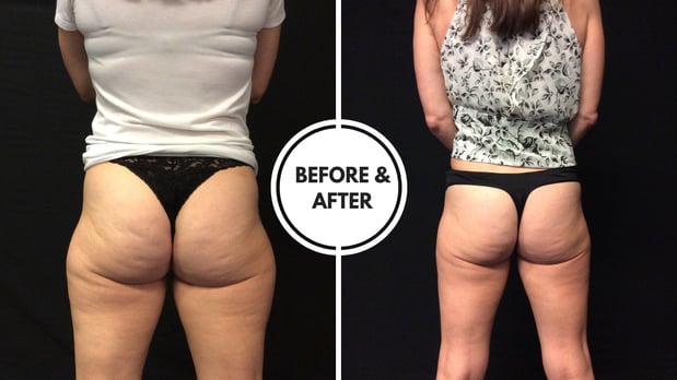 Images Hollywood Body & Face Denver/Metro