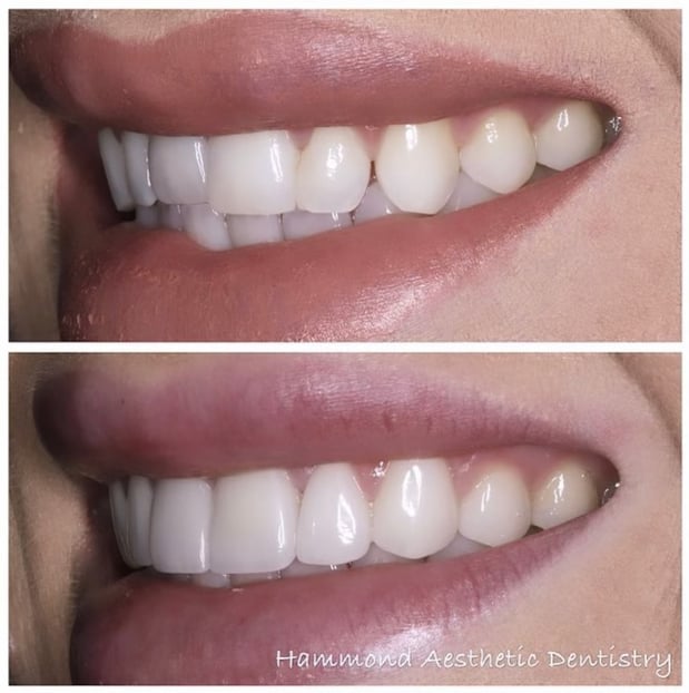 Images Hammond Aesthetic & General Dentistry