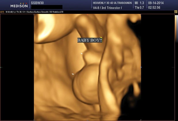 Images Heavenly 3D 4D Ultrasounds-Upland