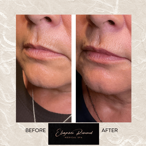 Images Elegance Renewed Medical Spa