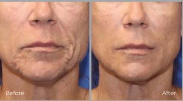 Images Tactus Health Aesthetics & Weight Loss Clinic