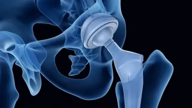 Images Dr. Jose A. Gallegos Cardenas