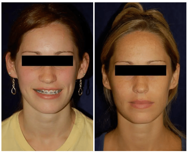 Images Columbia Aesthetic Plastic Surgery