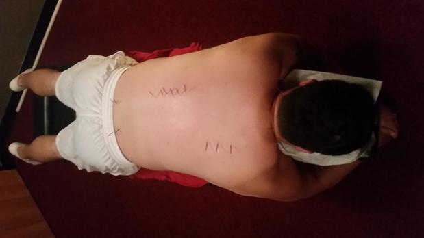 Images Ro Sports Chiropractic
