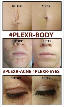 Images Renew Body Contouring & MedSpa