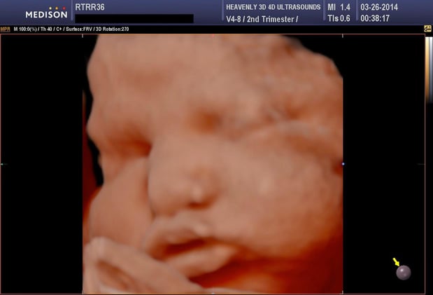 Images Heavenly 3D 4D Ultrasounds-Upland