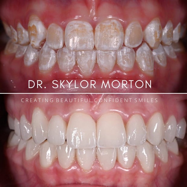 Images Nashville Wisdom Teeth and Implant Solutions