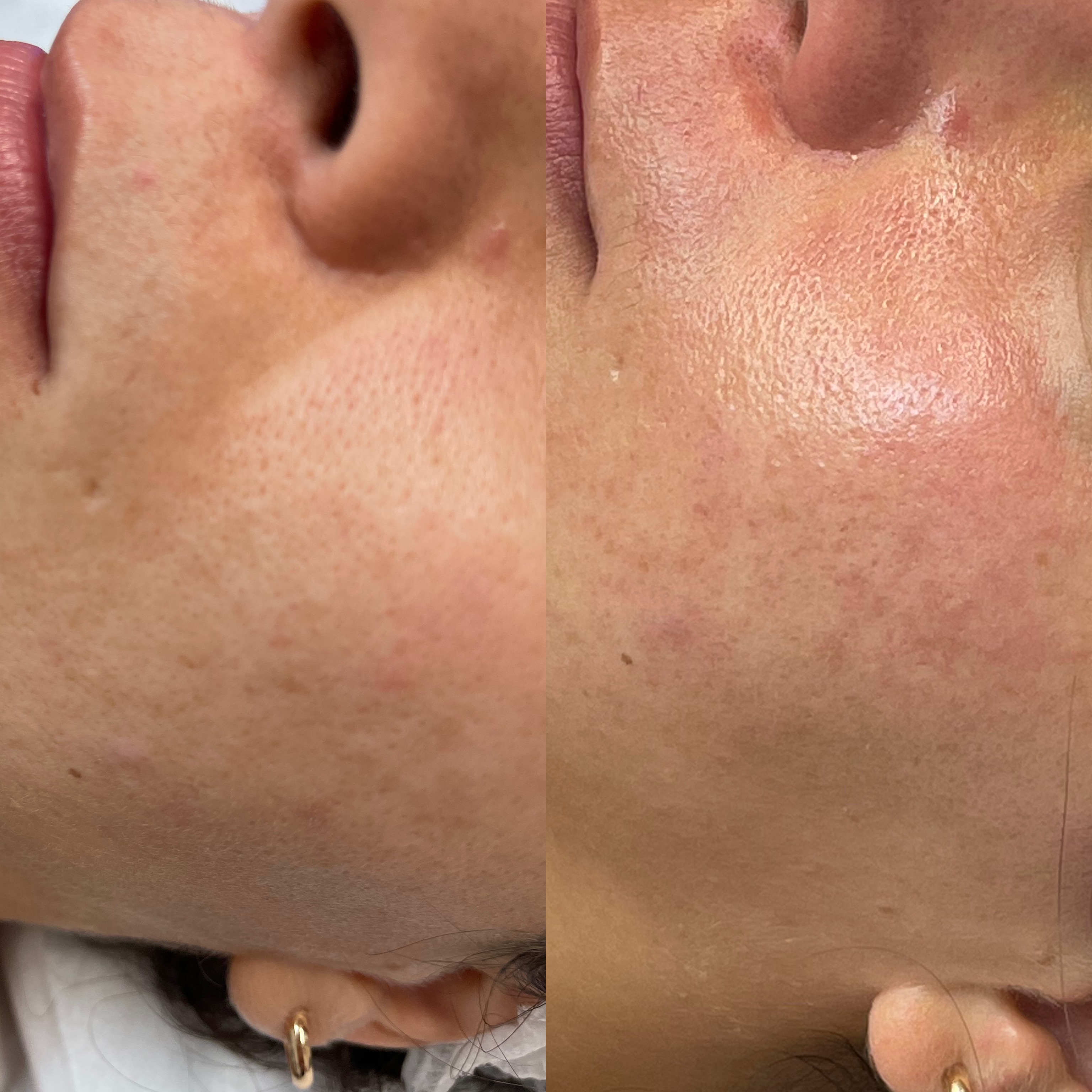 Images Clinique d'Esthétique Leila - Hydrafacial, Microblading, Épilation Laser Sainte-Foy