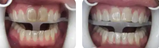 Images Paige Prather Smiles